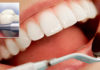 detartraj dentar in sector 2