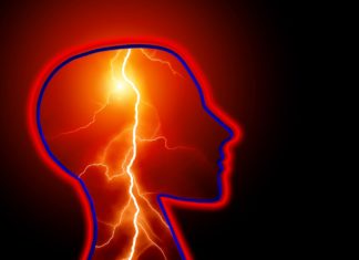 epilepsia