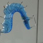 aparat dentar