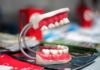 implant dentar