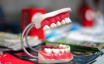 implant dentar
