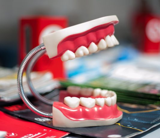 implant dentar