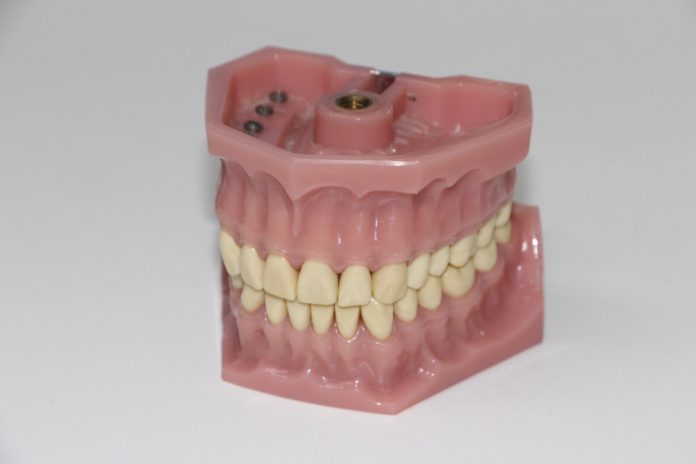 coroana dentara
