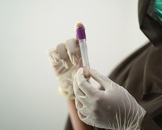 Imunodeficienta primara – simptome si diagnostic imunodeficienta