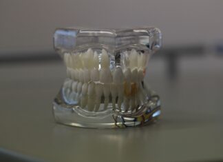 proteze pe implant