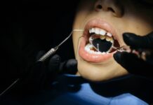 extractii dentare