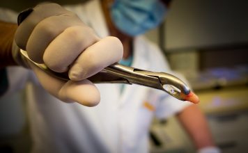 Cate tipuri de extractii dentare exista?