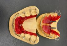 Aparat dentar ieftin