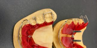 Aparat dentar ieftin