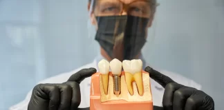 Se pot insera implanturi pterigoidiene la oameni în vârstă