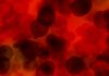 Talasemia