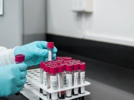 Grupele de sânge A, B, AB și 0, cu factorul Rh, compatibilitatea la transfuzii și miturile despre dietă și caracter grupele de sânge