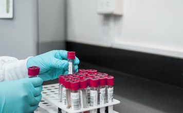 Grupele de sânge A, B, AB și 0, cu factorul Rh, compatibilitatea la transfuzii și miturile despre dietă și caracter grupele de sânge